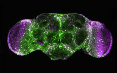 How resilient nerve cells fight back against dementia | UCL News - UCL – University College London